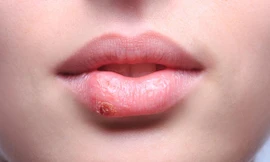 Ảnh minh hoạ: Internet