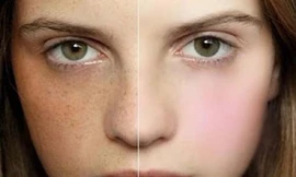 Ảnh minh hoạ: Internet