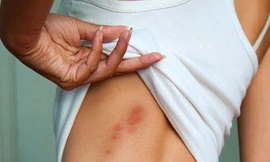 Ảnh minh hoạ: Internet