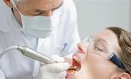 Sáu triệu chứng lão hóa răng