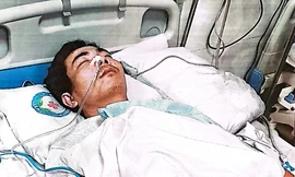 Sắp xét xử đối tượng đánh hàng xóm chấn động não, có tính chất côn đồ ở Hưng Yên