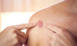 Ảnh minh hoạ: Internet