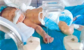 Một thanh niên gặp khó khăn cần trợ giúp