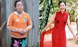 Cô gái biến thành bà lão có thể sinh con bình thường?