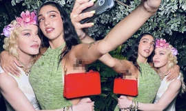 Con gái Madonna khoe ảnh selfie cùng mẹ, vô tư lộ 'violong' vùng nách kém duyên