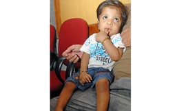 Bé 1 tuổi có 34 ngón tay và chân