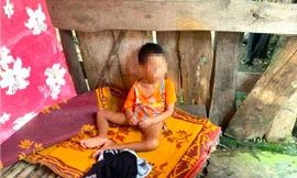 Bé 5 tuổi có nhiều vết thương bị đưa ra ở riêng trong lán tạm