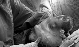 Hy hữu bé trai đẻ trong 'bọc điều may mắn' ngày đầu năm mới