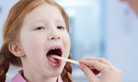 Khi nào cần cắt amidan?