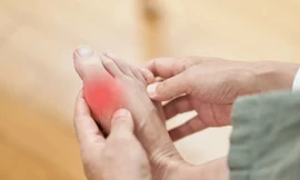 Những dấu hiệu cảnh báo bệnh gút mà bạn hay bỏ qua