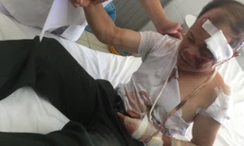 Tin mới vụ lật xe đèo Khánh Lê: 3 người chết, 23 người bị thương