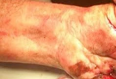 Nghi án đánh thuốc nổ sát hại bằng đèn pin