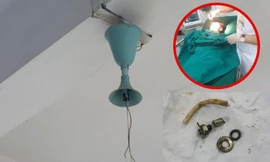 Học sinh ở Lào Cai đang ngồi trong lớp học thì bị quạt trần rơi, văng vào đầu