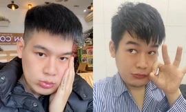 Hot TikToker Long Chun giữ tinh thần lạc quan sau 1 tháng điều trị u men xương hàm