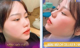 Bạn gái Quang Hải lên tiếng khi dân mạng truyền nhau ảnh cô nàng đi nâng mũi và sửa mặt