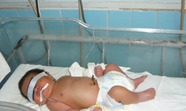 Sơ sinh nghi bị mẹ bóp mũi vứt vào thùng rác