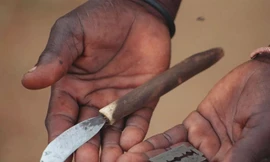 Rợn người hủ tục cắt bộ phận sinh dục của bé gái