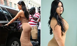 Chi hơn 200 triệu đồng để 'đại phẫu vòng ba' giống cô Kim