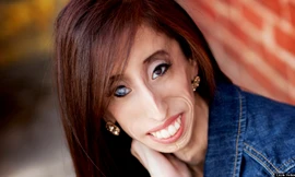 Bản lĩnh phi thường của “cô gái xấu xí nhất hành tinh“