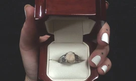 Chàng trai nhổ răng khôn... cầu hôn bạn gái