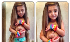 Kỳ lạ bé gái có quả tim 'đặt nhầm chỗ'