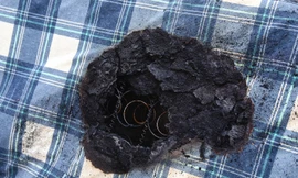 Tấm chăn điện cháy thành than gây bỏng chân của Kate