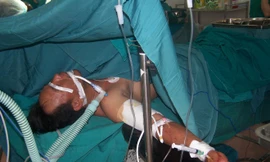 Các bác sĩ đang nối cánh tay cho anh Sửu