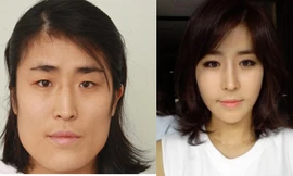 Dở khóc dở cười với các cô nàng 'vịt hóa thiên nga' sau thẩm mỹ