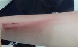 Cô bé 12 tuổi bị cha đánh phải nhập viện vì... 'ham chơi'