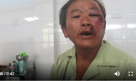 Ông Nguyễn Văn Tỵ kể lại sự việc 