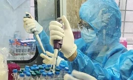 sinh viên Y khoa trường ĐH Tây Nguyên tham gia chống dịch tại Đắk Lắk.