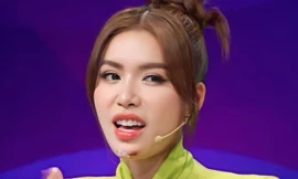 Người mẫu Minh Tú bị flycam đập vào mặt, khâu hơn 10 mũi