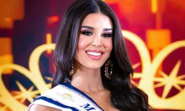 Nhan sắc gây tiếc nuối của người đẹp giành ngôi Á hậu Venezuela