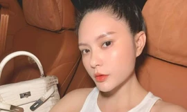 Bộ Y tế chỉ đạo làm rõ sai phạm liên quan đến công ty mỹ phẩm của vợ chồng Đoàn Di Băng 