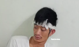 Chiều 12/5, tài xế Đinh Văn Điềm (quê ở huyện Nghĩa Hưng, tỉnh Nam Định) đã được xuất viện và trở về phòng trọ.