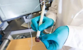 Bút chẩn đoán ung thư trong 10 giây