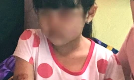 Bé gái nghi bị bạo hành ở Kiên Giang chưa đi học trở lại.