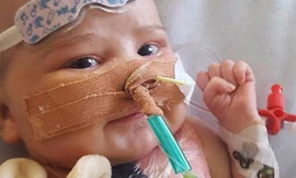 Bé trai chỉ có một nửa trái tim sống sót sau ca ghép tạng