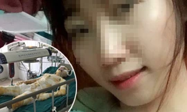 Nạn nhân trước và sau khi bị tẩm xăng đốt.