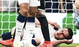 Jan Vertonghen chấn thương sau pha va chạm với đồng đội.
