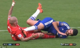 Diego Costa có hành vi xấu chơi với Skrtel.