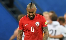 Vidal chấn thương là tổn thất lớn cho Chile.