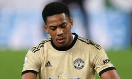 Anthony Martial bất ngờ dính chấn thương.