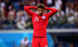 Dele Alli dính chấn thương đùi khá nghiêm trọng.