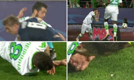 Vieirinha gãy răng sau pha thúc cùi chỏ của Kroos.