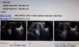 Kết quả siêu âm cho thấy chị D. không có thai