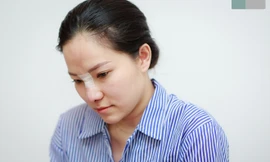 Lý Phương Châu quyết định sửa mũi để đón nhận những điều mới trong cuộc sống.