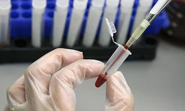 Ảnh minh hoạ: Internet