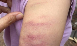 Giáo viên đánh học trò tím tay xin tha thứ để sửa sai