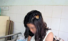 Thiếu nữ 9X bị rạch mặt vì khuyên đàn em bỏ chơi